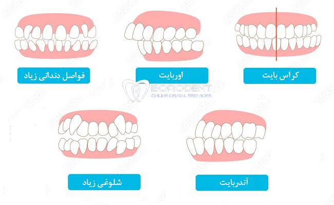 کاربردهای ارتودنسی
